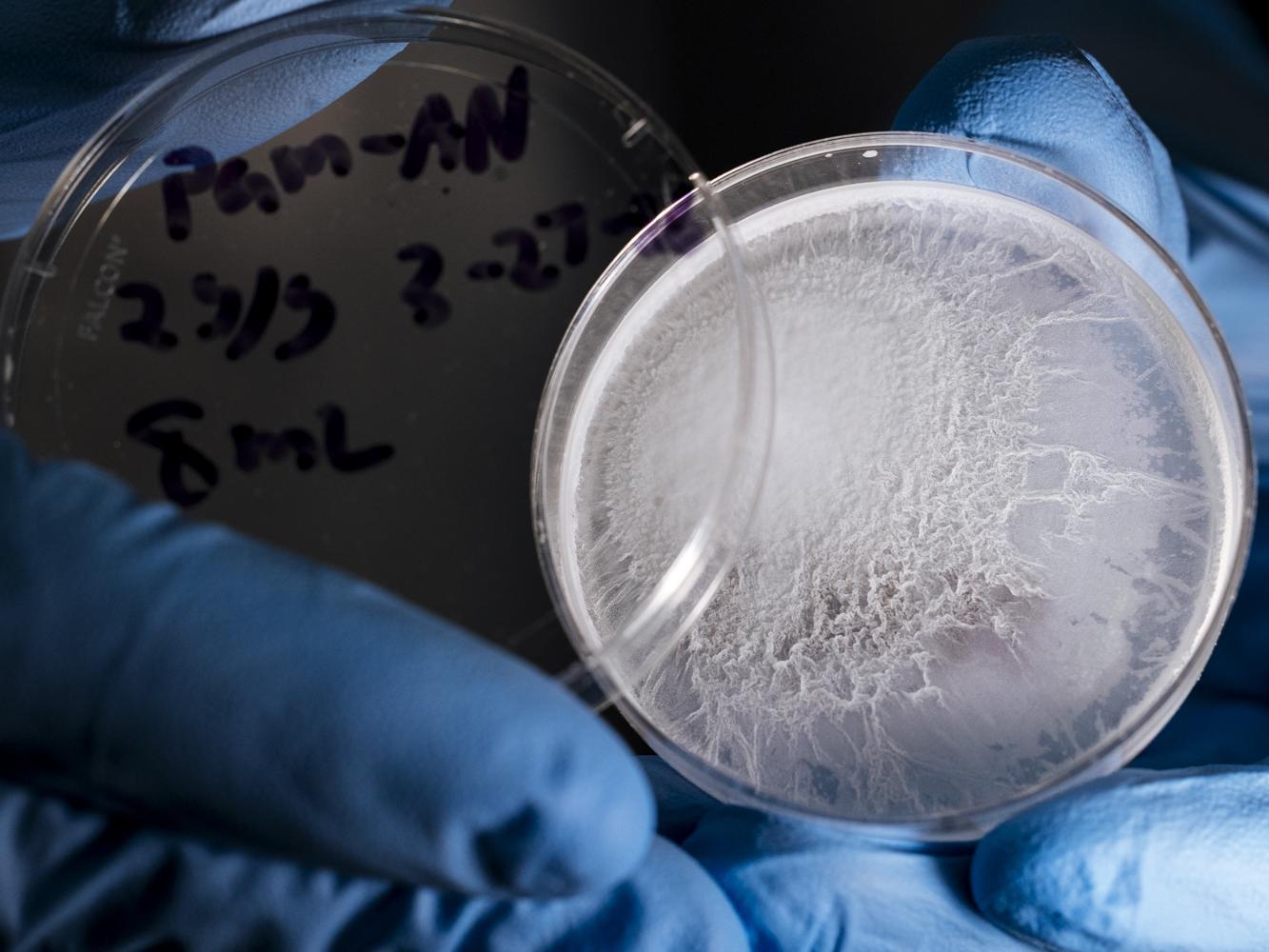 Petrischale mit Hydrogel.