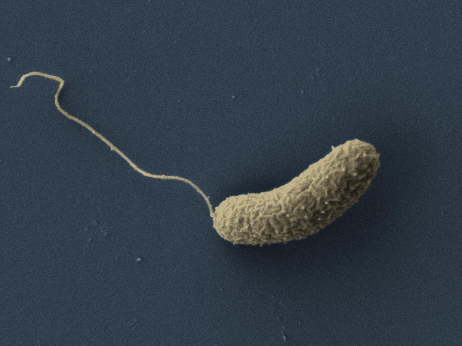 Elektronenmikroskopische Aufnahme eines Choleraerregers Vibrio cholerae (nachträglich koloriert).