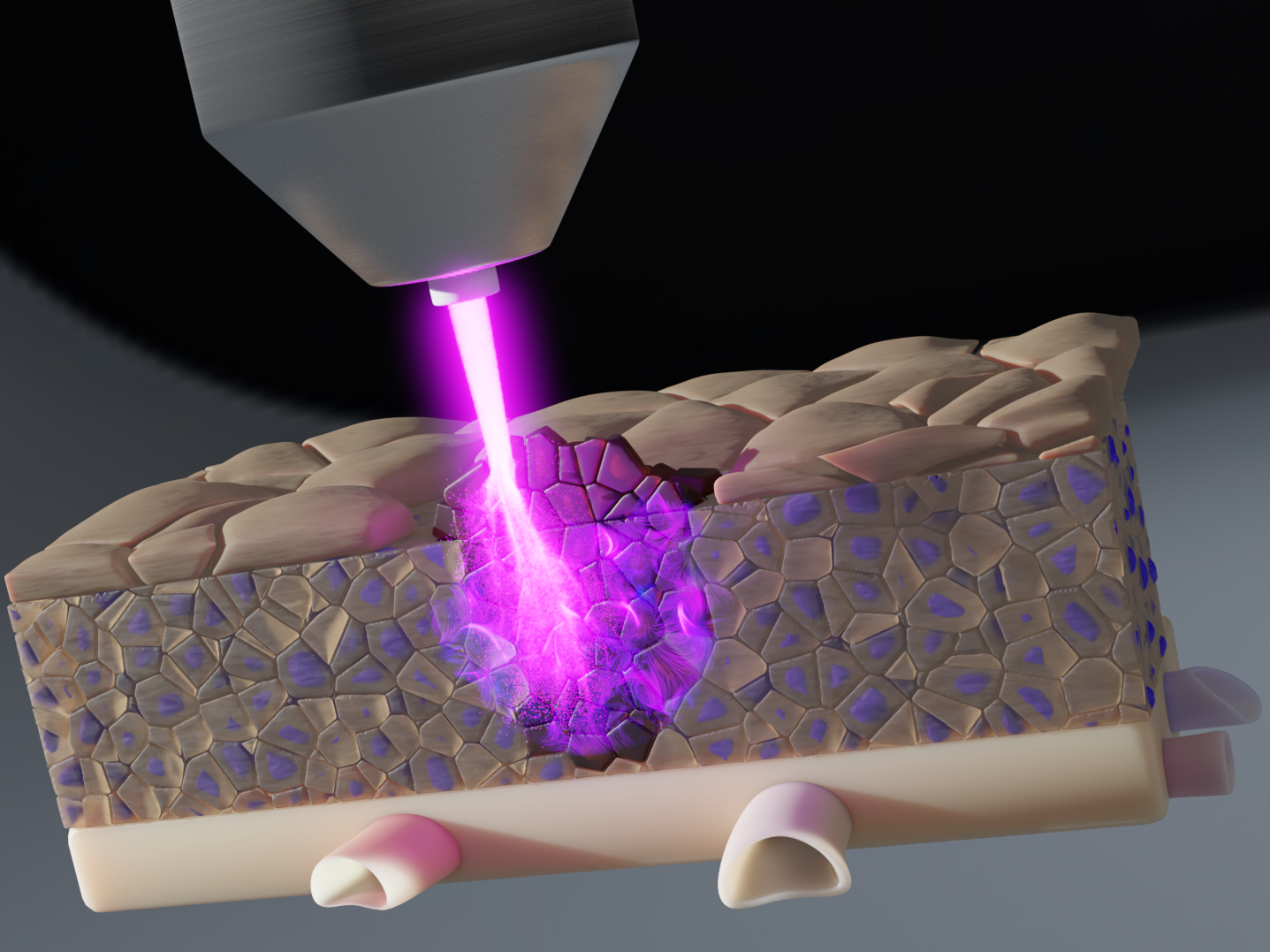 Behandlung von Tumorzellen mit kaltem Plasma